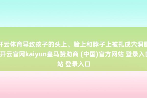 开云体育导致孩子的头上、脸上和脖子上被扎成穴洞眼-开云官网kaiyun皇马赞助商 (中国)官方网站 登录入口